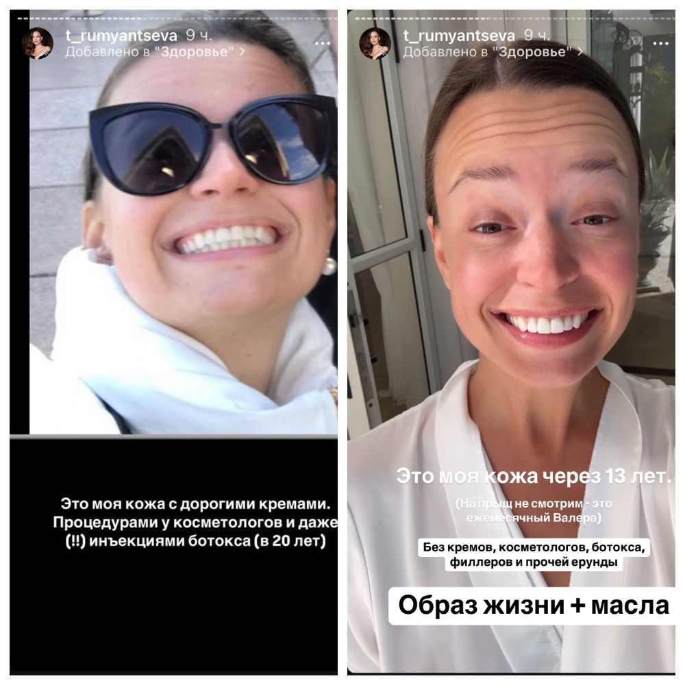 Как Таня Якунина (Румянцева) худеет, здоровеет и врет. Разоблачение. Часть 4